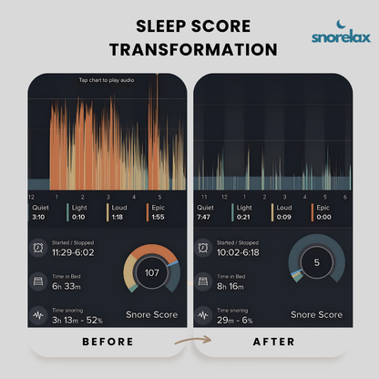 SnoreLax Pro Mouthguard